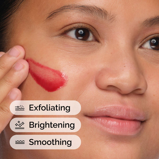aha-30-bha-2-peeling-solution-b4 ord-aha-bha-peeling-solution-model-application-with-benefits.jpg