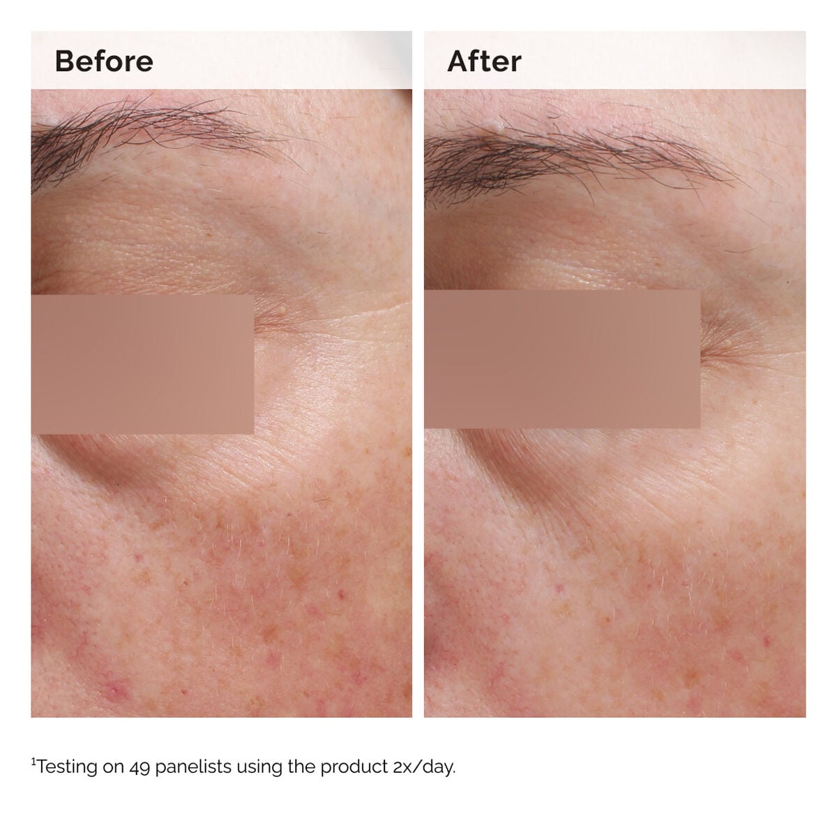 niacinamide-5-face-and-body-emulsion-m1 2024-08-23-ORD-Nia-5pct-Face-Body-B-A-Elasticity-Global-02-1x1.jpg