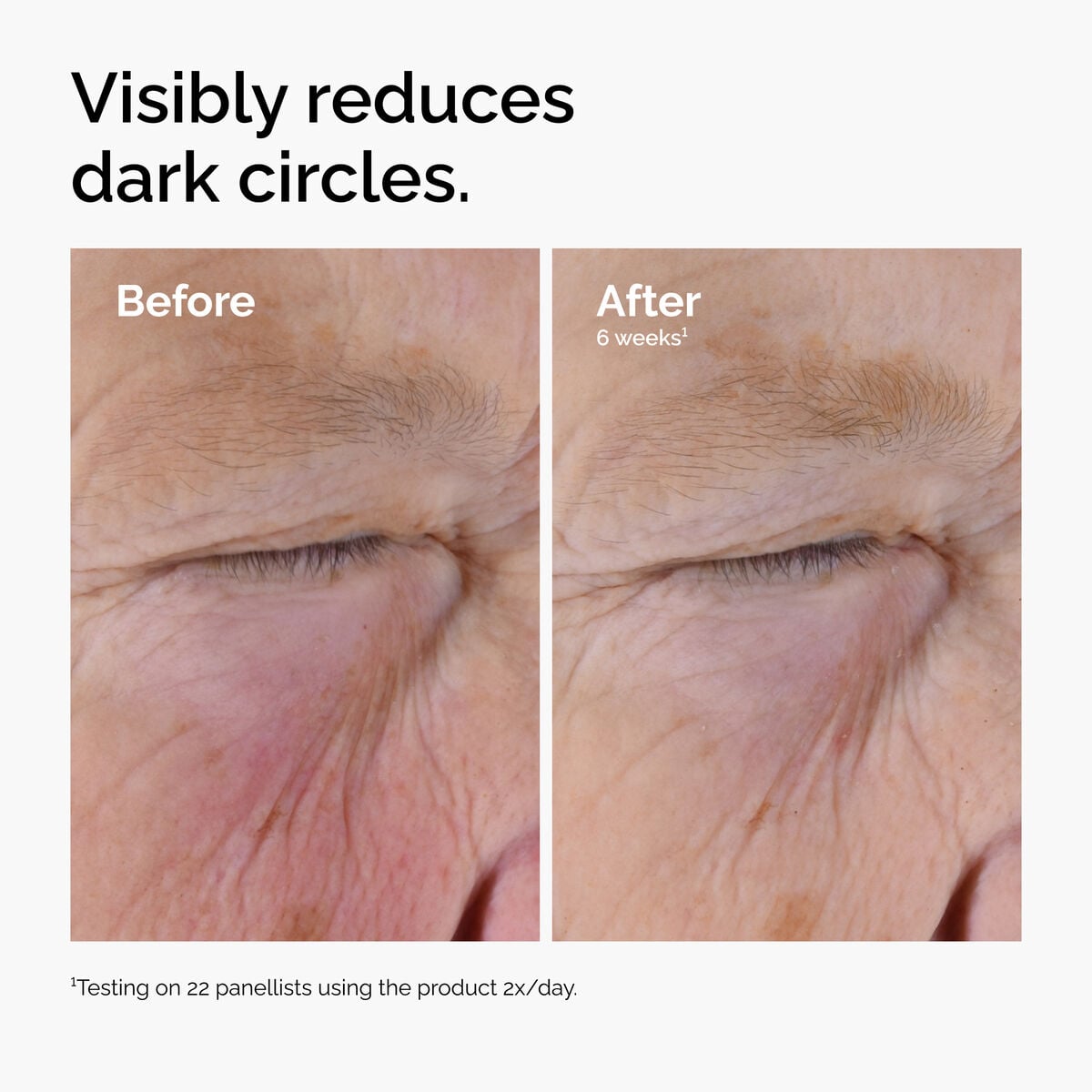 caffeine-solution-5-egcg-eye-serum-g7 ord-caffeine-solution-egcg-dark-circles-before-after.jpg