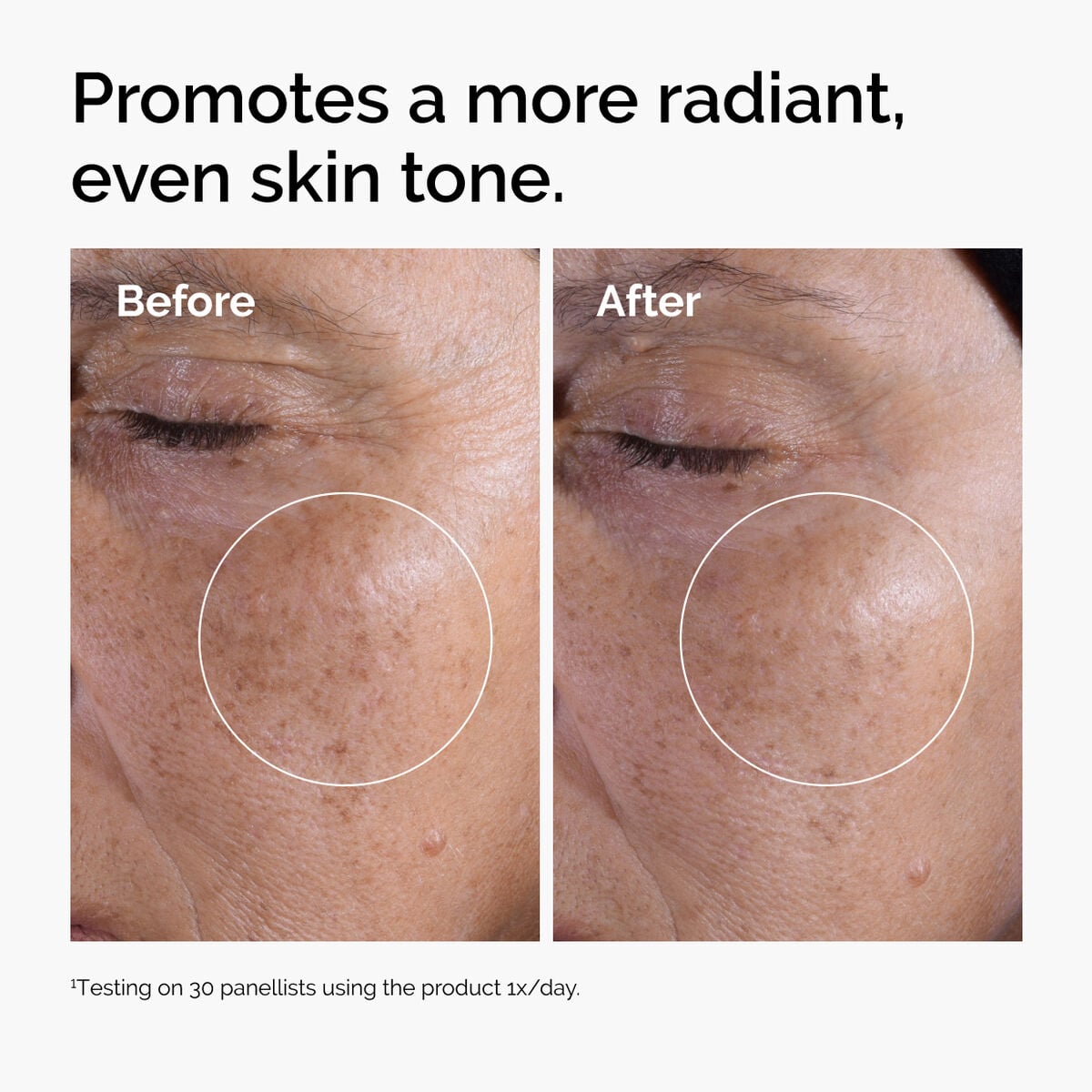glycolic-acid-7-exfoliating-toner-x7 ord-glycolic-before-after-radiance.jpg
