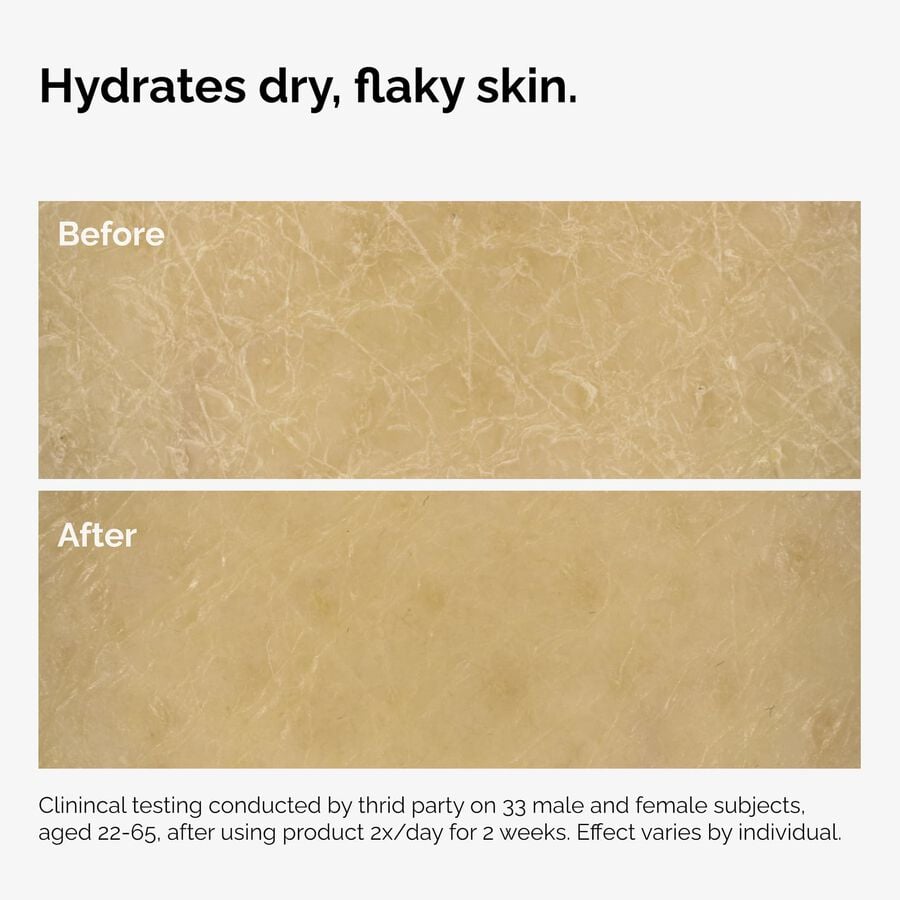 the-body-care-collection-v5 ord-natural-moisturizing-factors-inulin-body-before-after-graphic-02.jpg