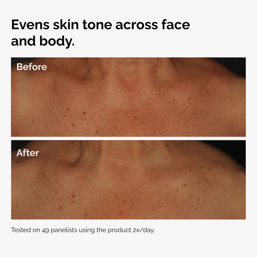 the-body-care-collection-v5 ord-niacinamide-face-body-serum-before-after-even-tone-graphic.jpg