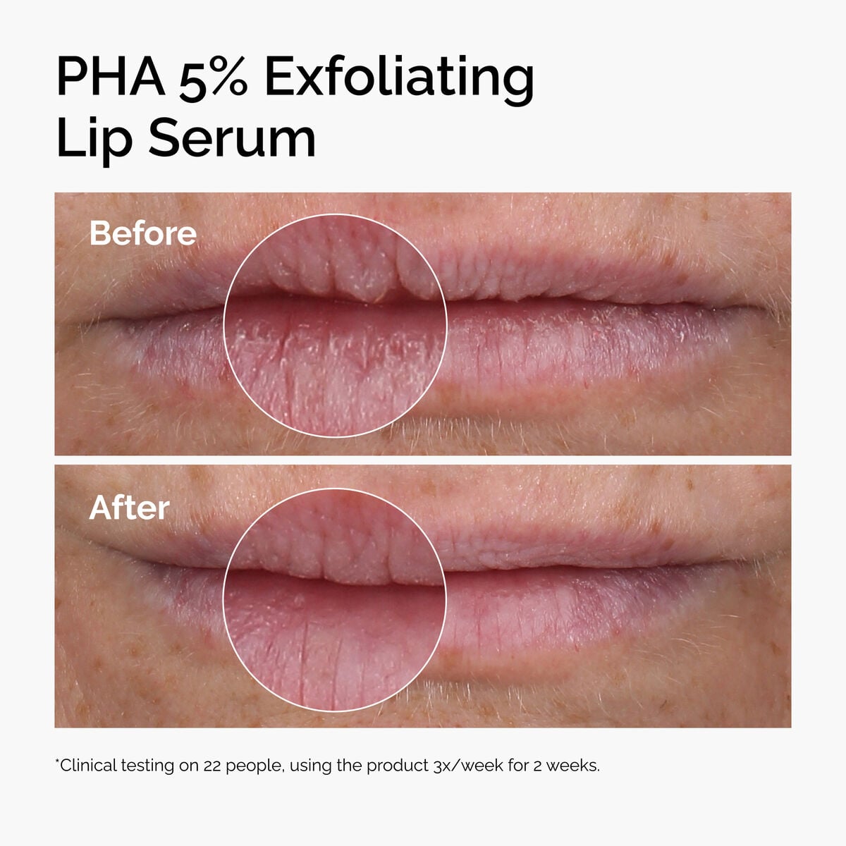 pha-5-exfoliating-lip-serum-w1 ord-pha-5pct-lip-exfoliating-serum-before-after.jpg